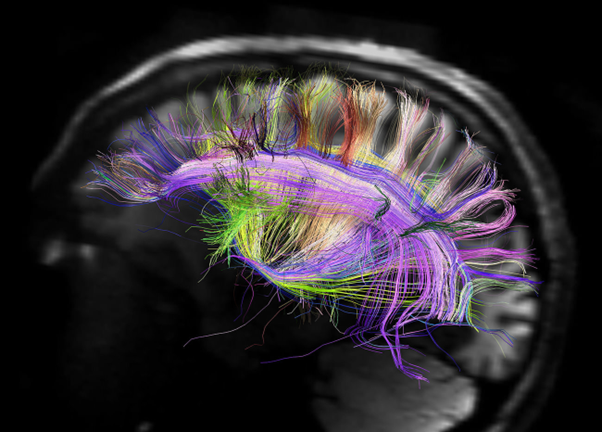 qué es el neuromarketing 